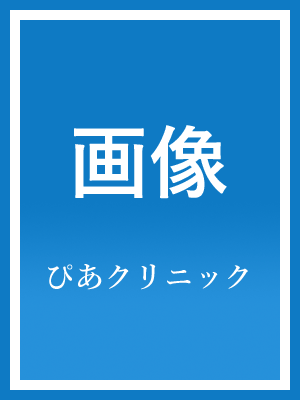 縦画像フレーム